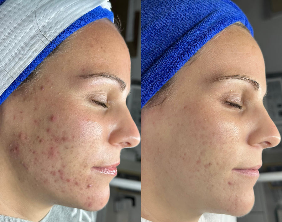 Before and after