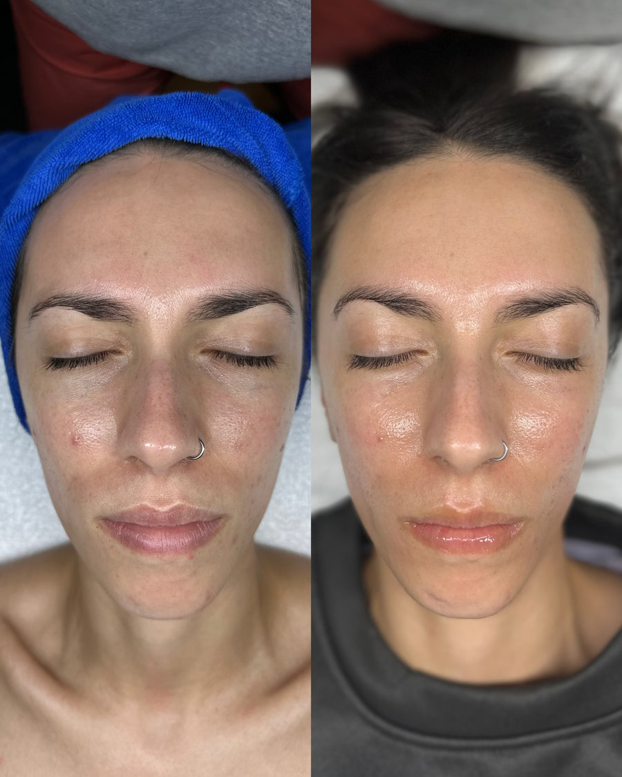 Before and after