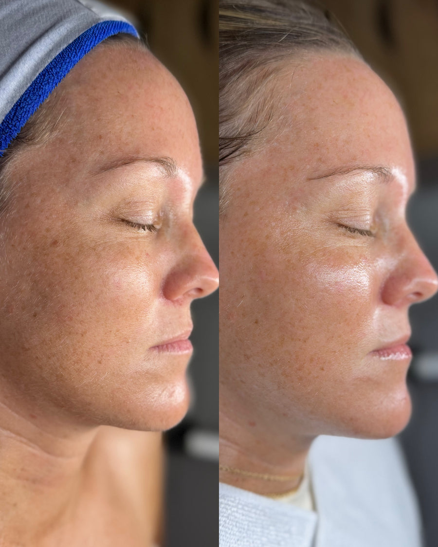 Before and after