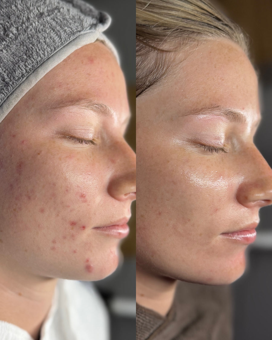 Before and after