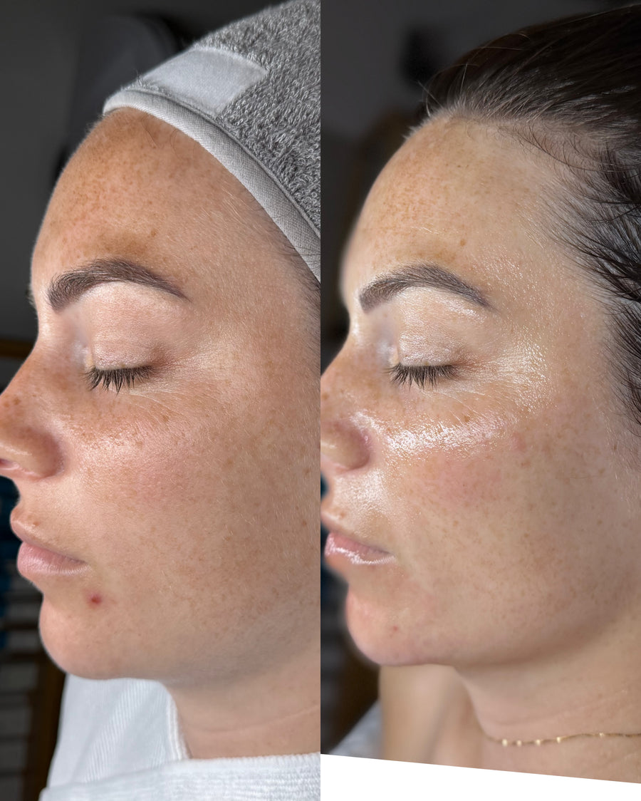 Before and after