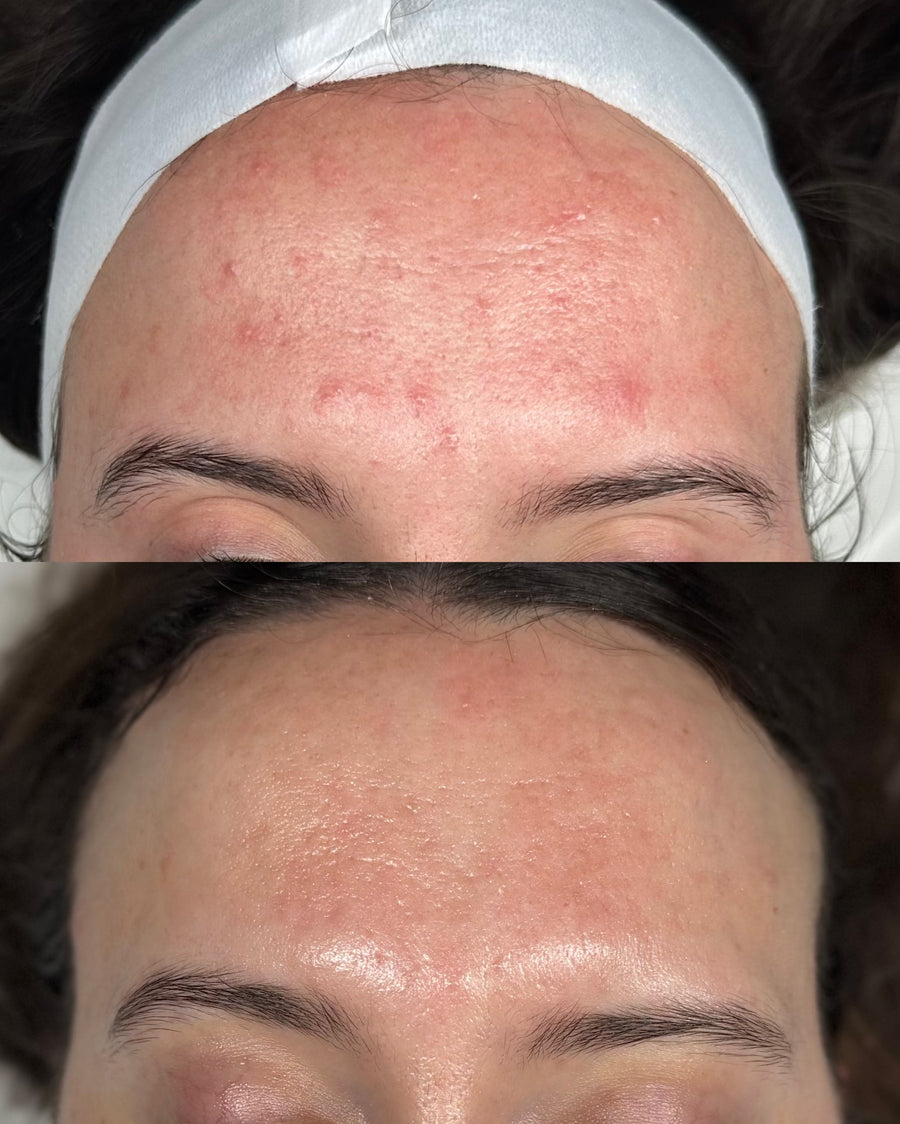 Before and after