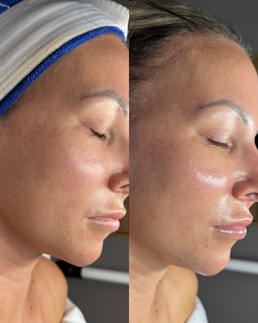 Before and after