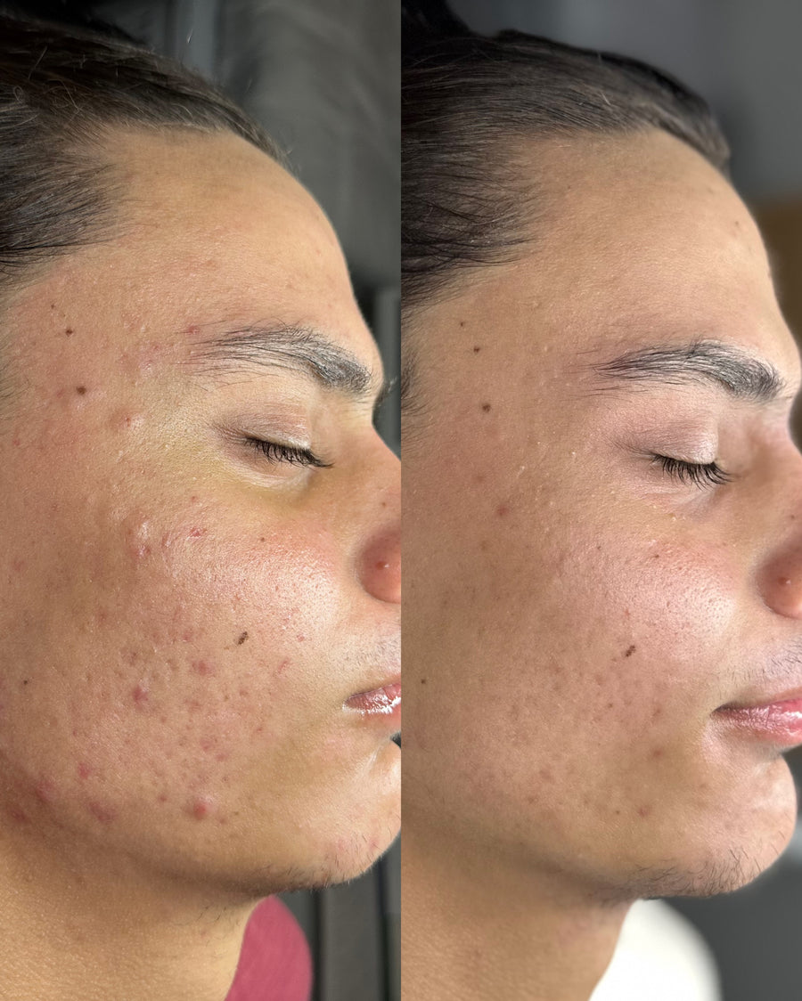 Before and after