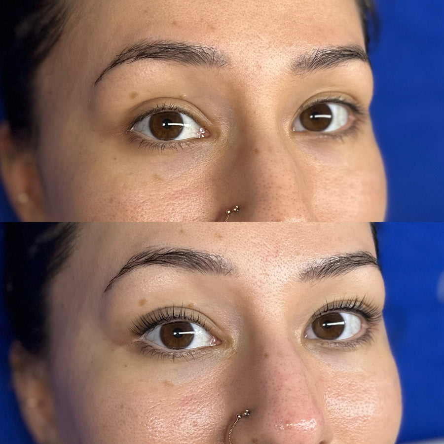 Before and after