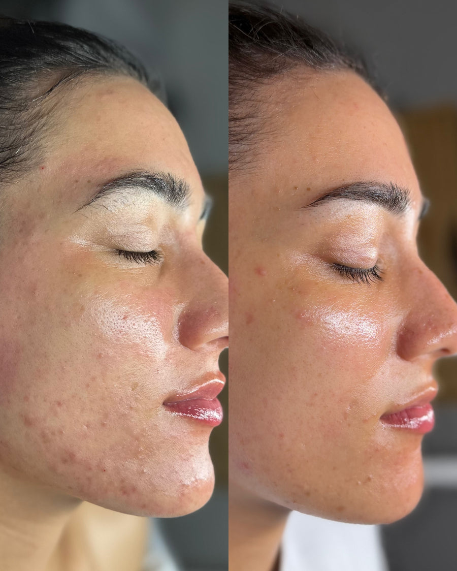 Before and after