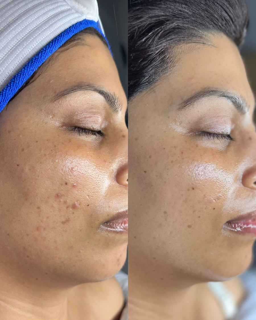 Before and after