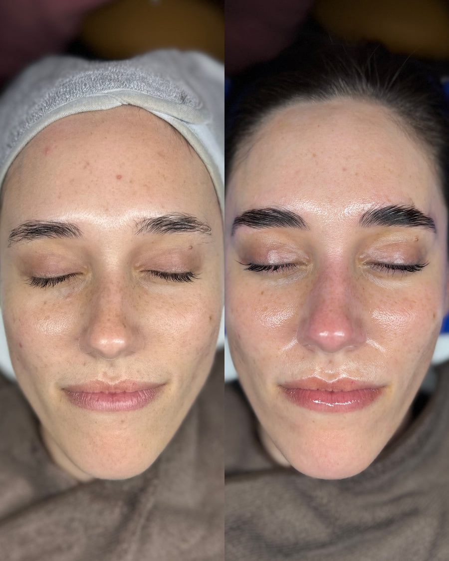 Before and after