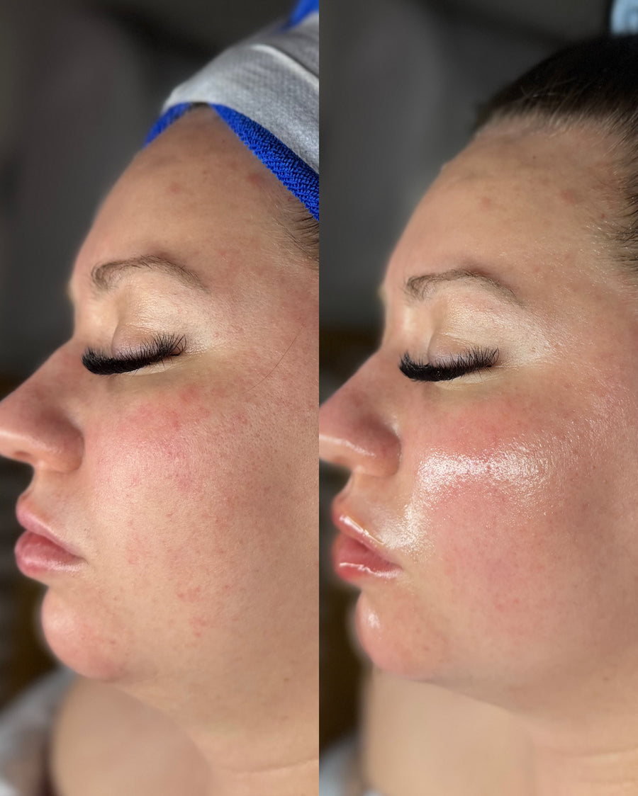 Before and after