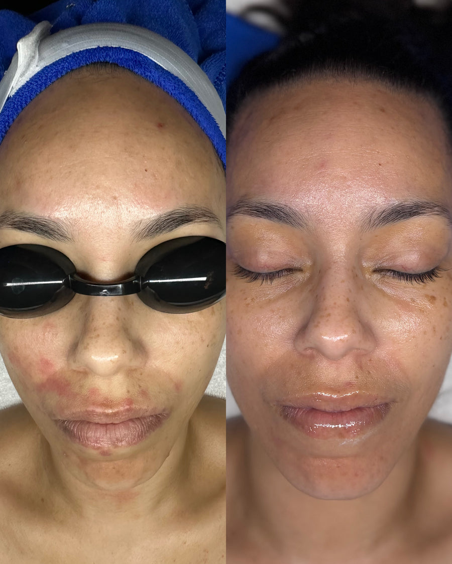 Before and after