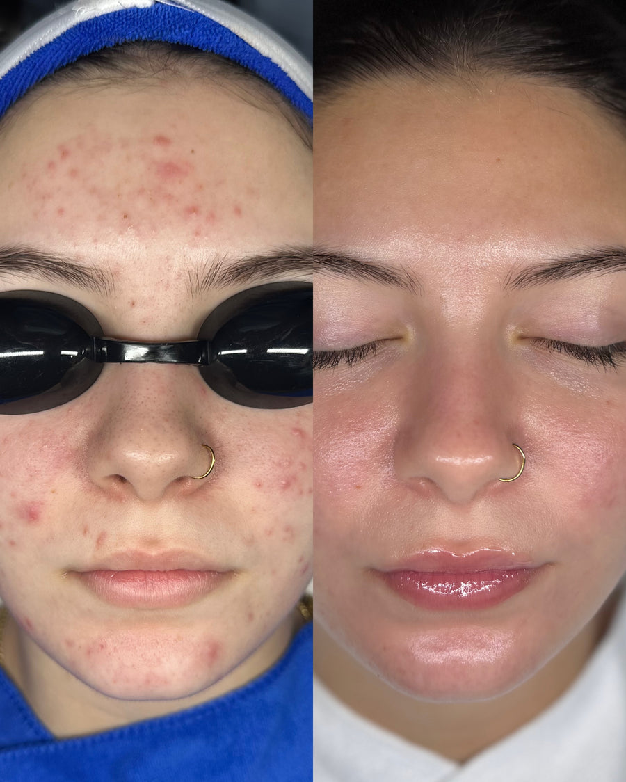 Before and after